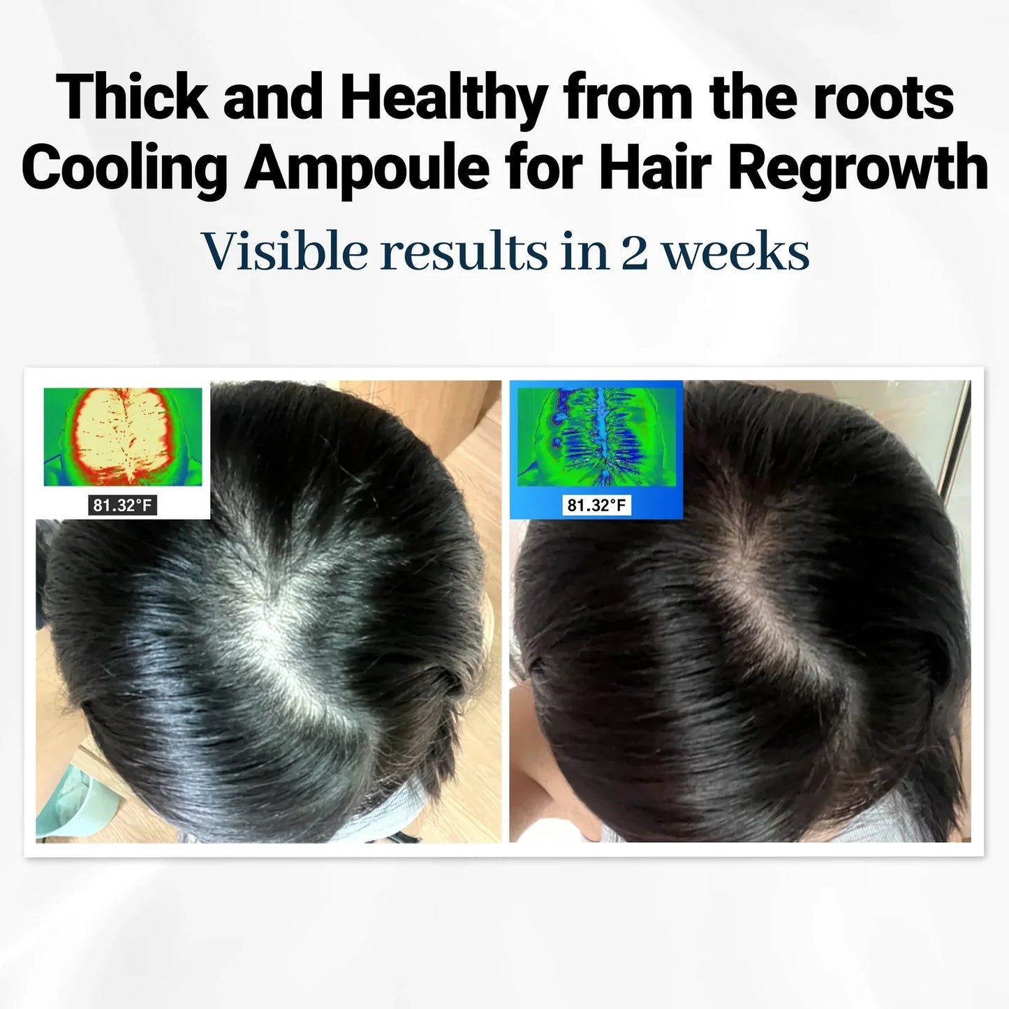 RootBloom™ Hair Growth Elixir