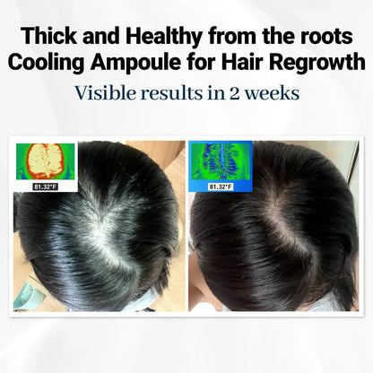 RootBloom™ Hair Growth Elixir