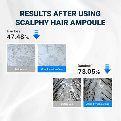 RootBloom™ Hair Growth Elixir